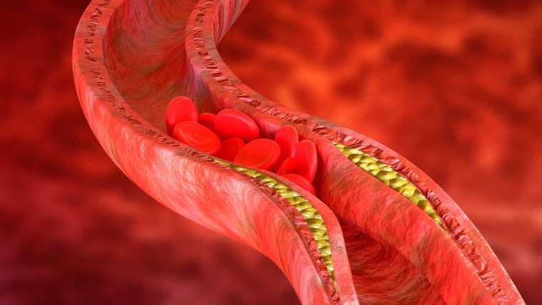 Clinicas Medfyr - Nuestro Blog - ¡Tengo el colesterol alto!